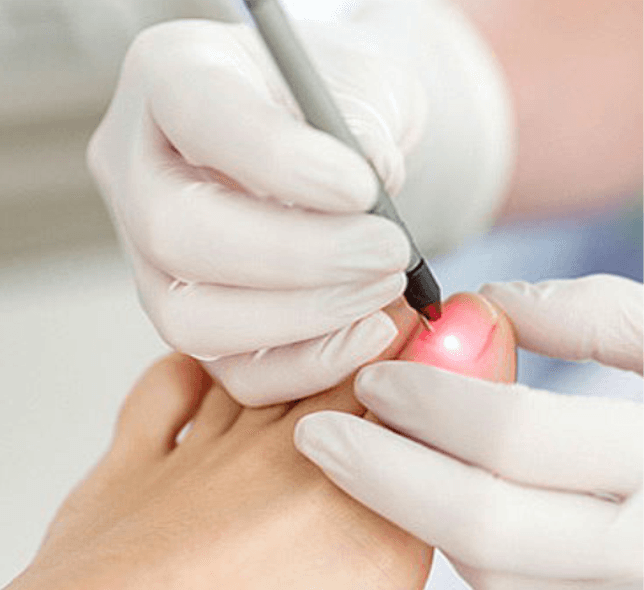 Laserterapia
